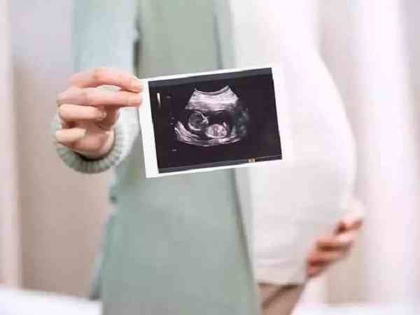 男孩女孩b超区别图解：胎心率、孕囊形状、胎儿位置是依据