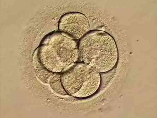 移植两个胚胎只成功一个，失败的会自己排出来吗？
