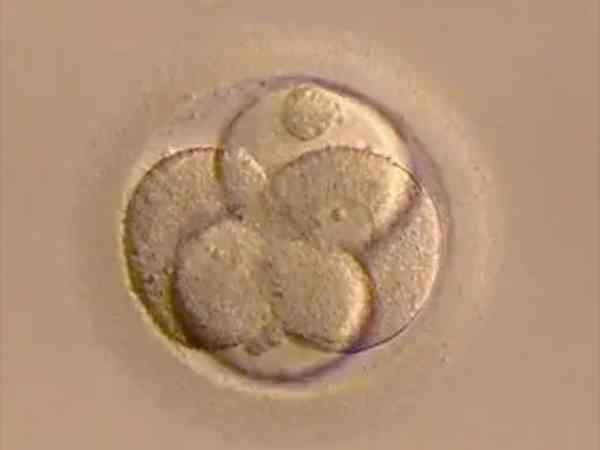 不知原肠胚是不是胚胎，看完其形成过程就知答案