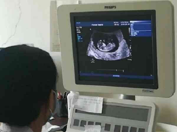 为什么医生建议不用做NT检查？孕周不足、胎位不正是主因