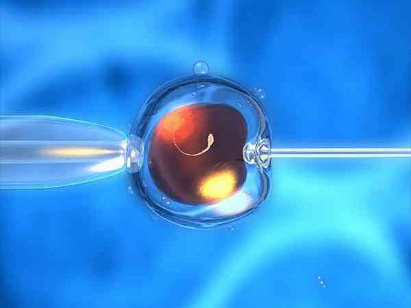 试管选择二代的原因分析：对精子的要求低只是优势之一