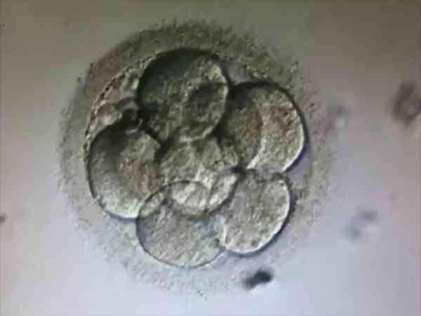 早期胚胎辅助孵化的作用有哪些？3大好处详细分析