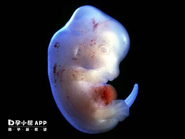 胚胎停止发育就叫胎停