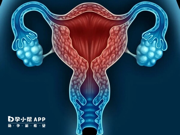 宫腔感染会导致自然流产
