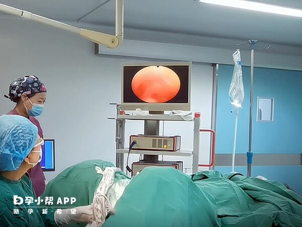 医生正在进行宫腔镜清宫手术