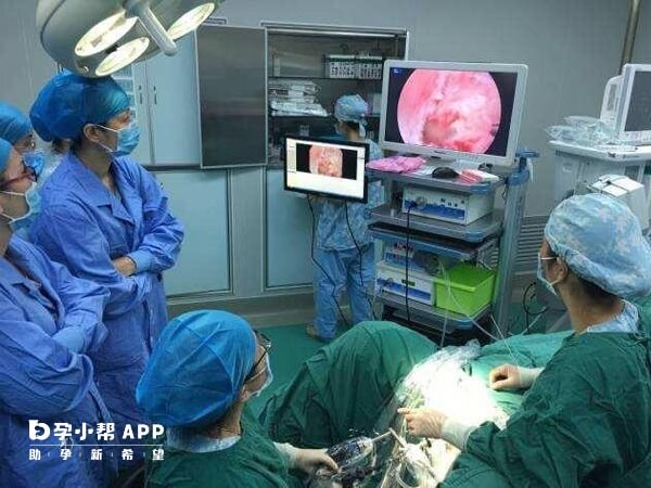 宫腹腔镜手术过程中