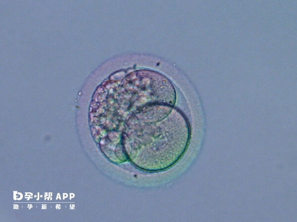 A囊胚为优质胚胎