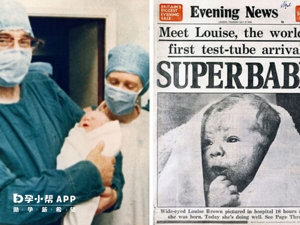 1978年全球诞生了第一例试管婴儿