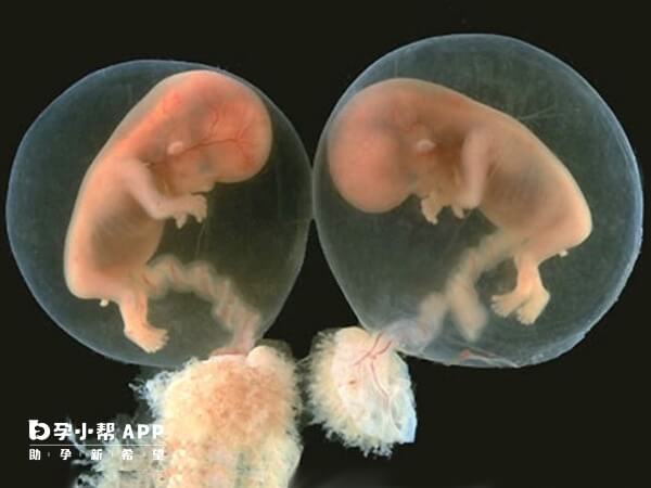 囊胚移植后有可能分裂为双胎