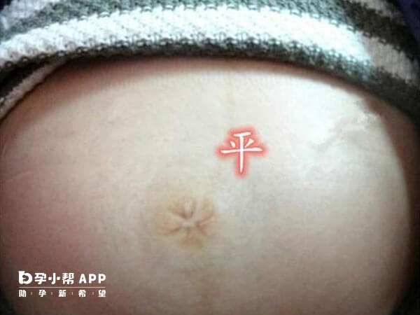 孕妇肚脐眼形状不受腹中胎儿性别影响