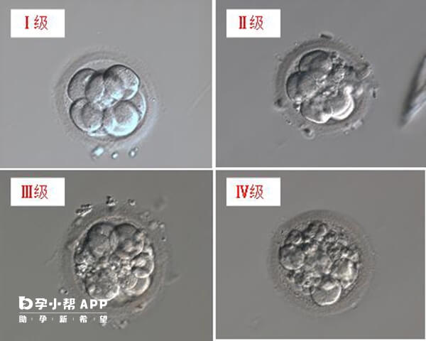 第三天胚胎可以划分为四个级别