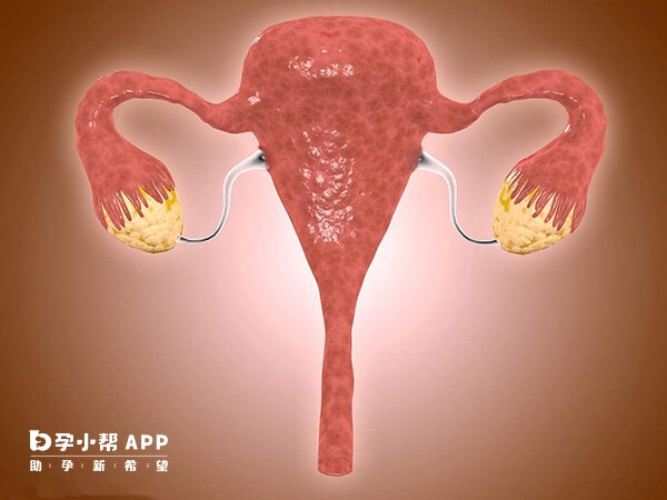 黄体期促排适合卵巢功能好的患者