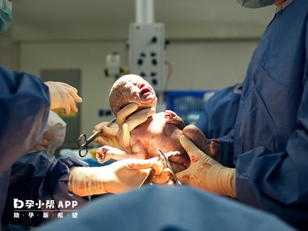 子宫畸形患者生孩子多为剖腹产