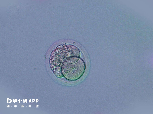 4bb囊胚着床成功率较高