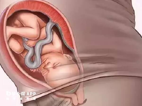 随着胎儿生长对宫颈压迫就越大