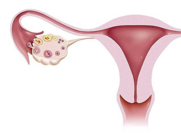 子宫内膜厚度影响移植成功率