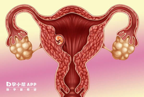 胚胎着床需要足够的孕酮