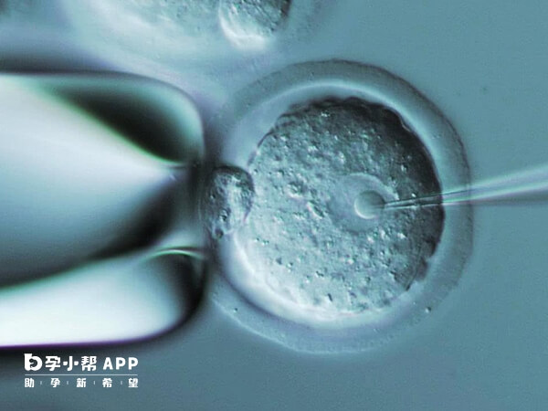 胚胎移植是没有痛感的