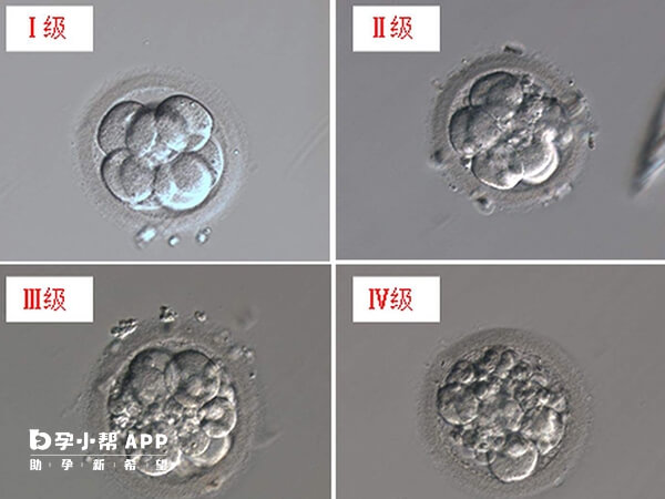 不同级别胚胎养囊成功率不一样
