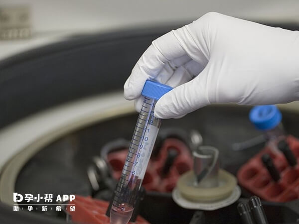 南京有4家医院可以做供精人工授精