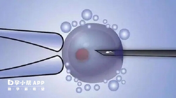 卵子质量好容易养成优质胚胎