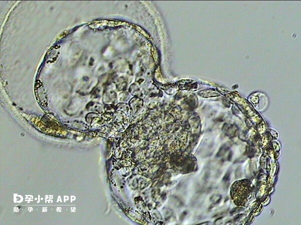 4aa囊胚容易分化