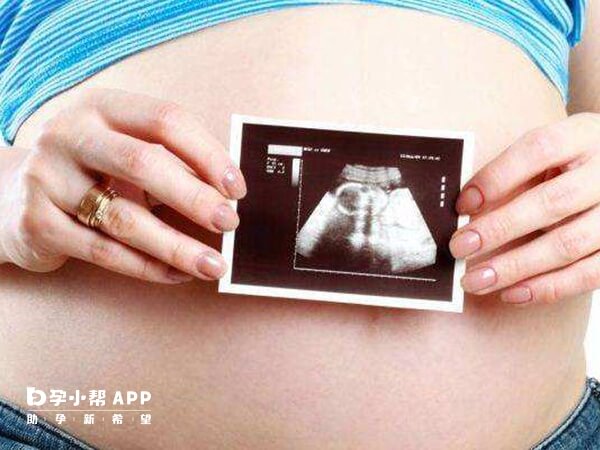 b超看胎儿生殖器准确度高