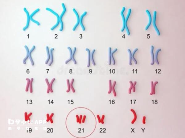染色体多态性属于正常变异
