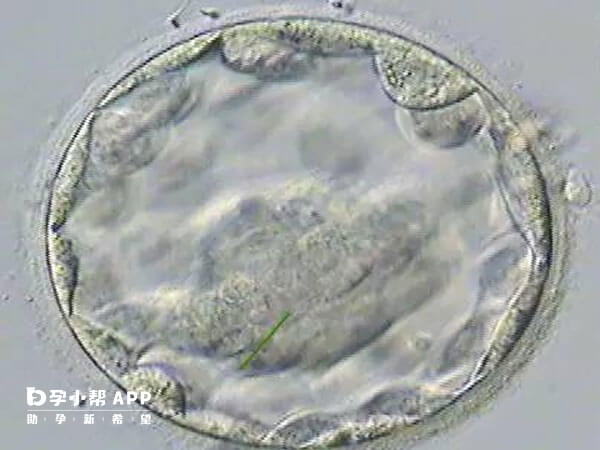胚胎发育缓慢可选择养囊培养