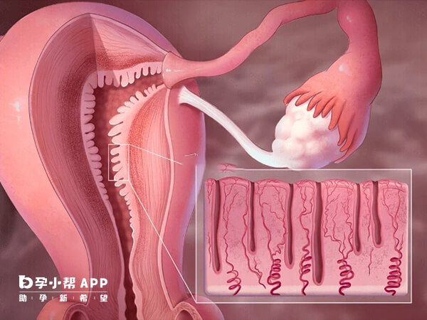 子宫内膜a型最适合受孕