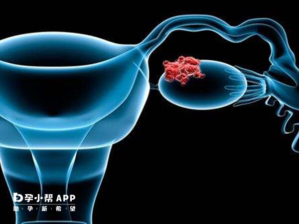 卵巢早衰做3代供卵试管成功率较高