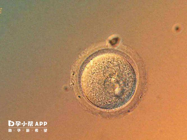 43岁基础卵泡只有一个自然受孕几率极低