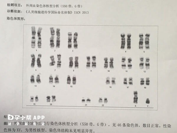 高龄试管前需要做染色体检查