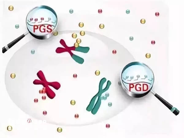 泰国PGD和PGS基因检测技术准确率高