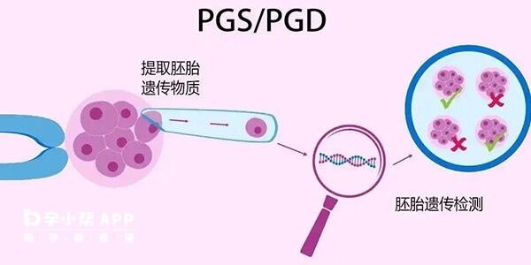 三代试管pgd和pgs并不能筛查所有遗传病