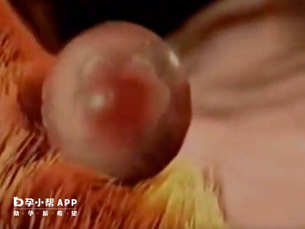 鲜胚移植要求内膜厚度在8到14mm