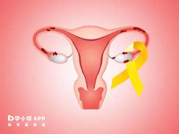 子宫内膜薄可以通过孕激素或者是雌激素进行改善