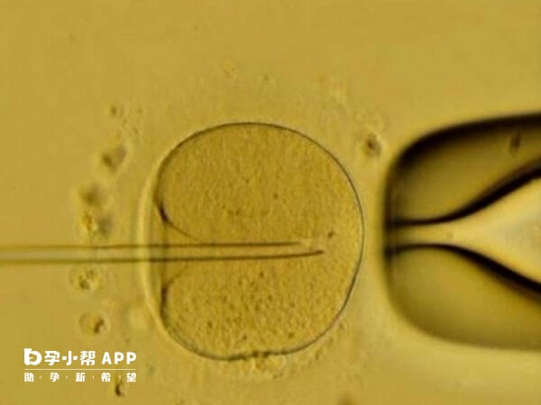 icsi技术也叫做单精子卵胞浆内显微注射技术