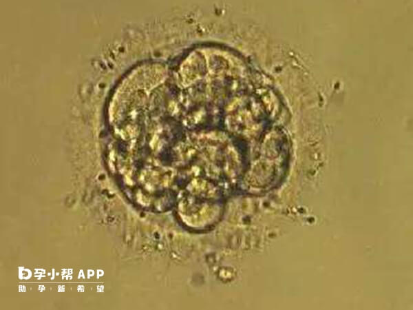 胚胎生化后多会随着月经排出体外
