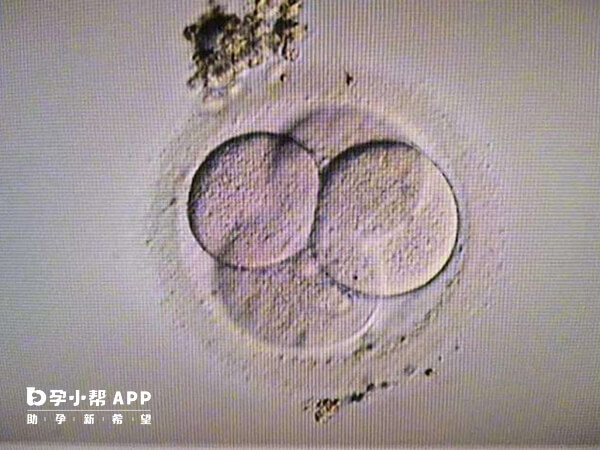 胚胎生化一般发生在移植后半个月左右