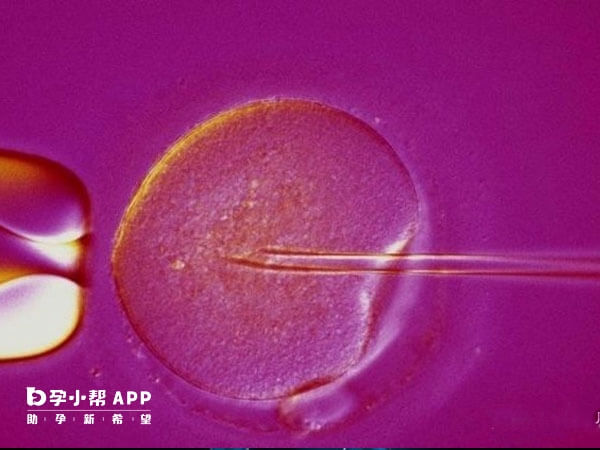 输卵管堵塞可以通过试管婴儿助孕