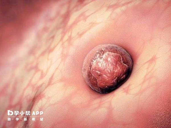 子宫内膜ab适合移植冻胚