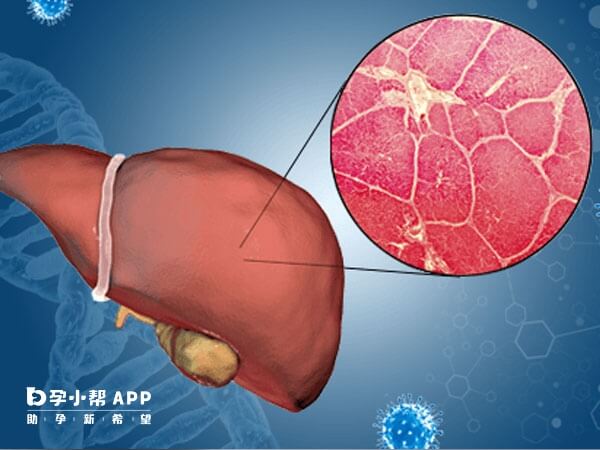 转氨酶升高说明肝功能受到损伤