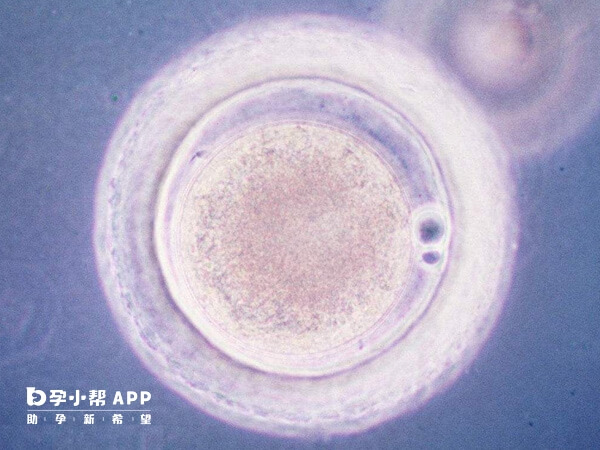 胚胎退化原因有多种