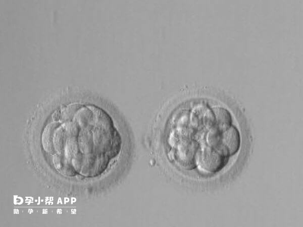 b级胚胎是试管婴儿过程中最为常见的胚胎