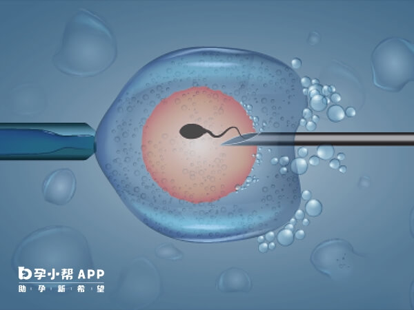 卵子激活适用于二代试管受精异常的情况