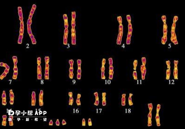 遗传原因导致的2号染色体三体需要做三代试管