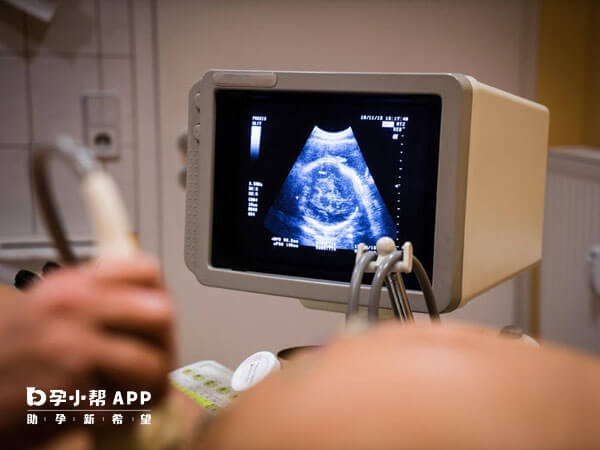 在孕晚期可以通过B超检查出头盆不称