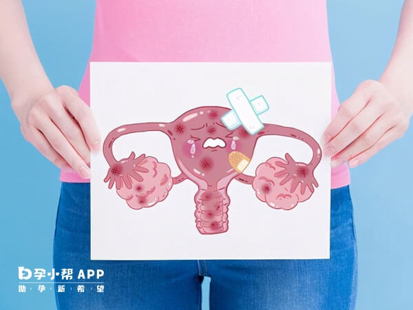 卵巢过度刺激会导致促排期间肚胀
