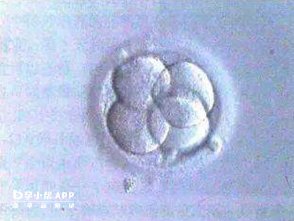 411胚胎发育潜能不佳